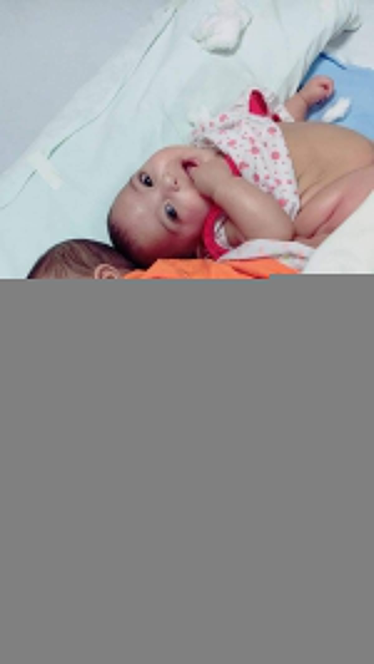      استجابت لجنة الاستغاثات الطبية بمجلس الوزراء لاستغاثة طلب إجراء عملية جراحية لفصل منطقتي الظهر والفخذ لتوأمتين ملتصقتين تبلغان من العمر 12 شهرا، تقيم أسرتهما في محافظة الدقهلية