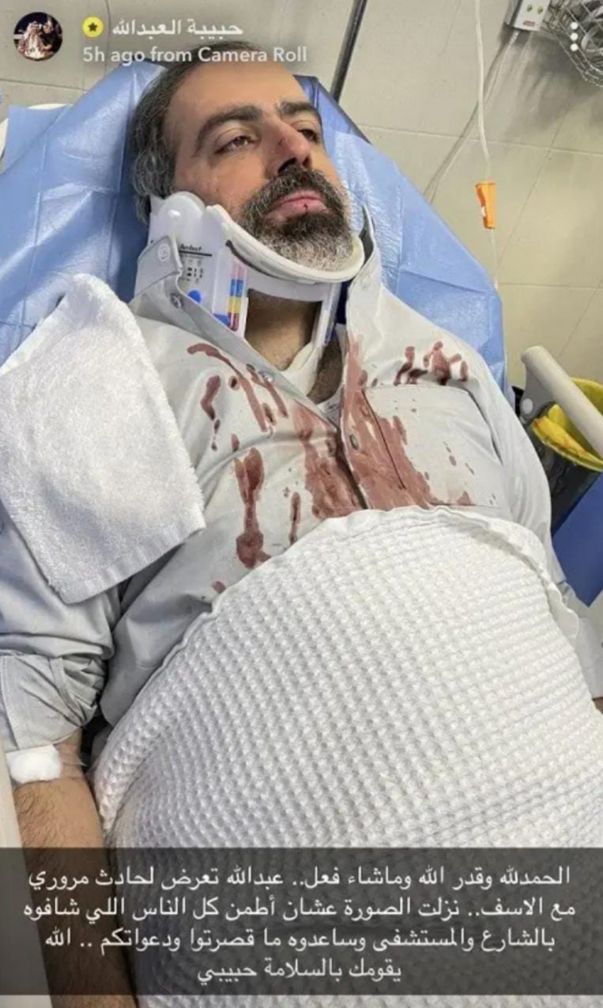 تعرض الفنان عبدلله التركماني لحادث مريع