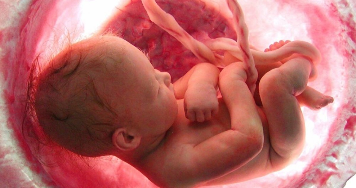 أسباب قلة المياه حول الجنين.. وطرق الوقاية والعلاج