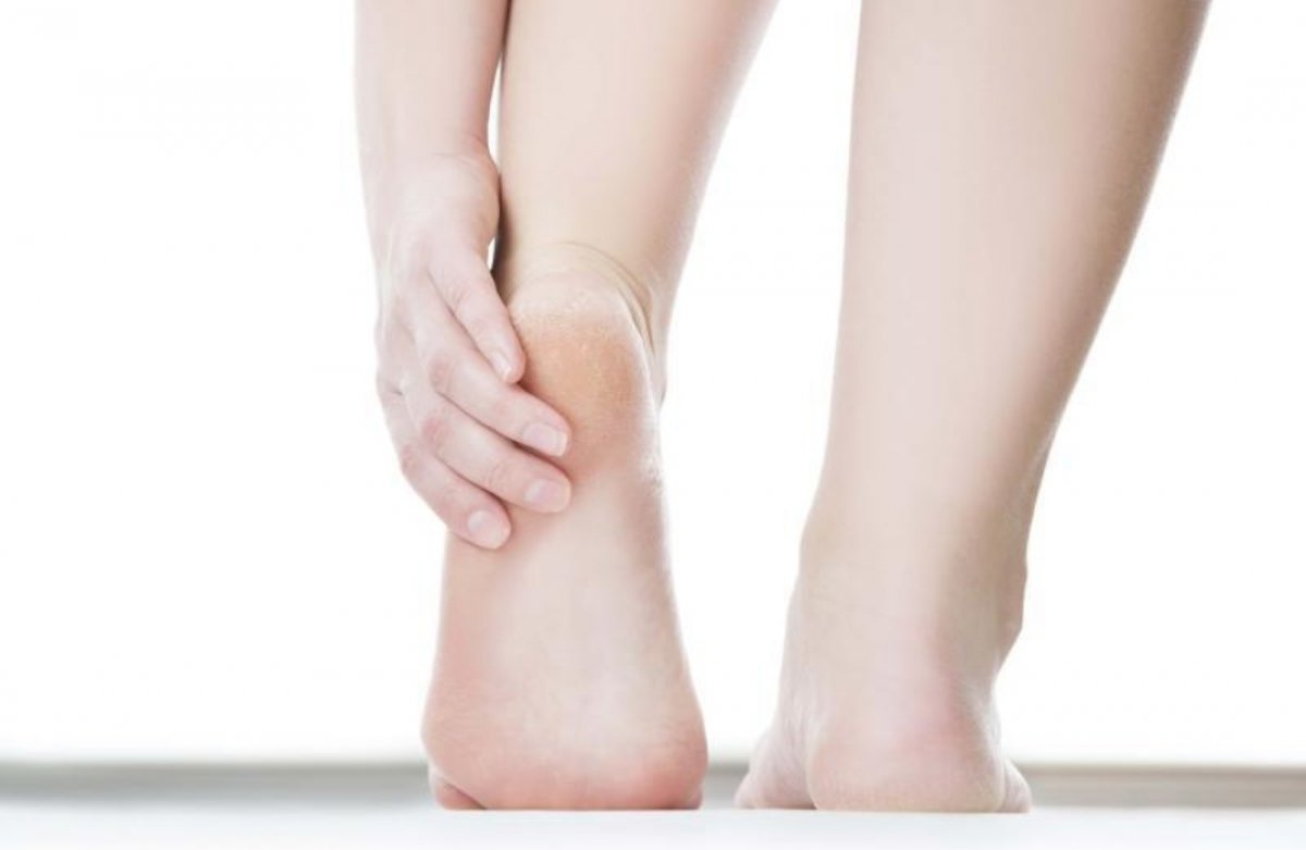 وصفات منزلية "بالجلسرين" للتخلص من خشونة القدمين
