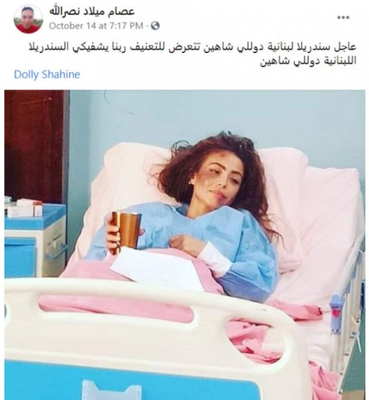 دوللي شاهين في المستشفي إثر تعرضها لضرب مبرح من مجهولين