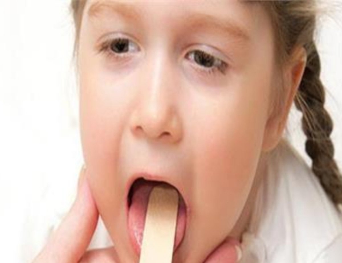 علاج احتقان الحلق عند الأطفال 