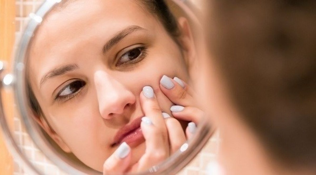 كريم سحري يزيل البثور في يوم واحد يدهش مستخدمي تيك توك