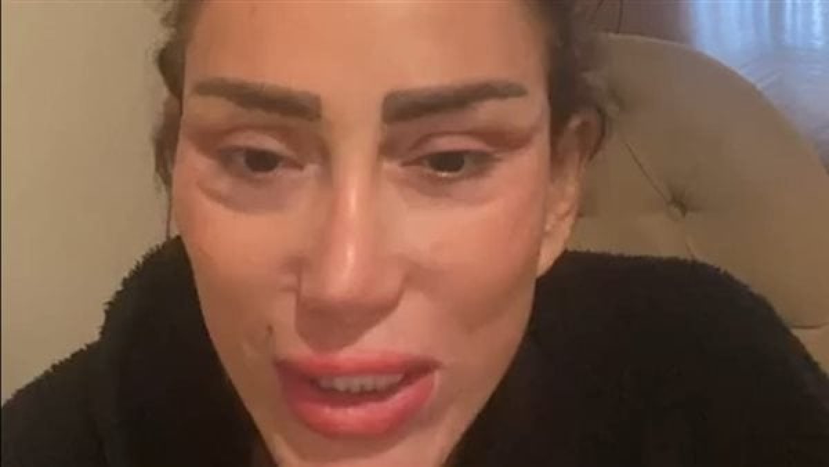 وجهها تشوه بالكامل.. هل يمكن مقاضاة طبيب ريهام سعيد؟