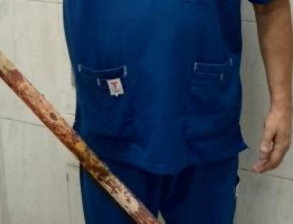 استخراج ماسورة مياه طولها متر من صدر شاب إثر حادث تصادم بالشرقية