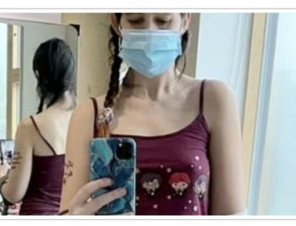 ضحت بساقها من أجل جنينها