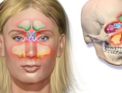  تعرف على تشابه أعراض نزلة البرد إلى حد كبير مع أعراض التهابات الجيوب الأنفية